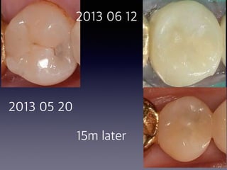 38
2013 05 20
2013 06 12
15m later
 