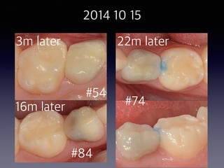 2014 10 15
#54
#74
#84
22m later
16m later
3m later
 