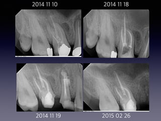 2014 11 10 2014 11 18
2014 11 19 2015 02 26
 