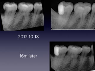 17
2012 10 18
16m later
 