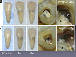 ProRoot MTA
Angelus MTA
baseline 4w 8w
 