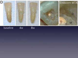 Endocem MTA
baseline 4w 8w
 