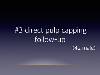#3 direct pulp capping
follow–up 
(42 male)
 