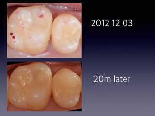 2012 12 03
20m later
 