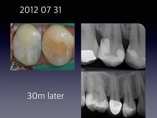 2012 07 31
30m later
 