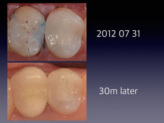 2012 07 31
30m later
 