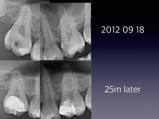 2012 09 18 
 
 
 
 
2012 09 18
25m later
 