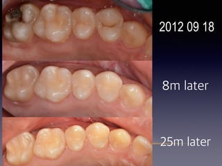 2012 09 18
25m later
8m later
 