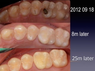 2012 09 18
8m later
25m later
 