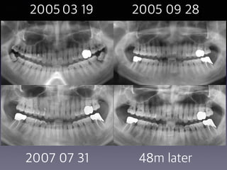 2005 03 19 2005 09 28
2007 07 31 48m later
 