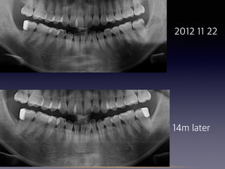 2012 11 22
14m later
 