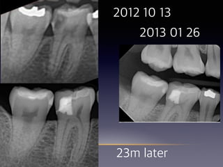 2013 01 26
2012 10 13
23m later
 
