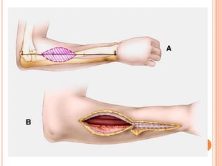 Vat gian cot sau.pptx