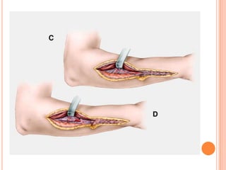 Vat gian cot sau.pptx