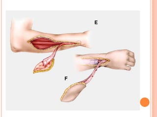 Vat gian cot sau.pptx