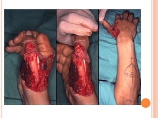 Vat gian cot sau.pptx