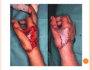 Vat gian cot sau.pptx