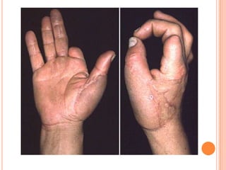 Vat gian cot sau.pptx