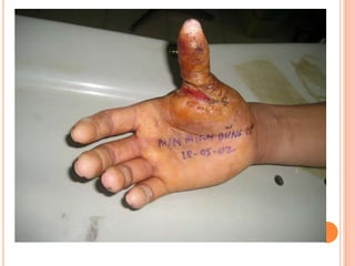 Vat gian cot sau.pptx