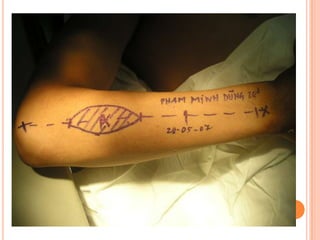 Vat gian cot sau.pptx