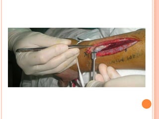 Vat gian cot sau.pptx