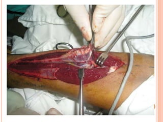 Vat gian cot sau.pptx