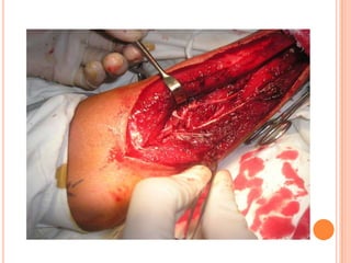 Vat gian cot sau.pptx