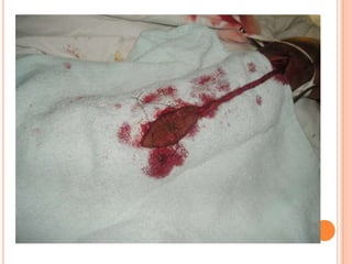 Vat gian cot sau.pptx