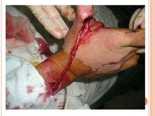 Vat gian cot sau.pptx