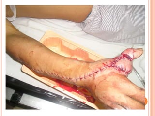 Vat gian cot sau.pptx