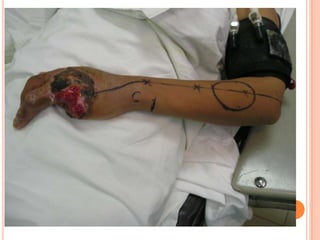 Vat gian cot sau.pptx