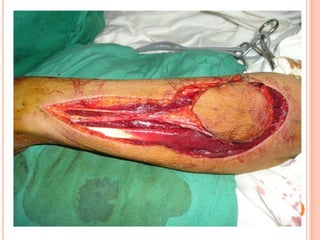 Vat gian cot sau.pptx