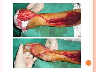 Vat gian cot sau.pptx