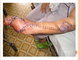 Vat gian cot sau.pptx