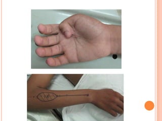 Vat gian cot sau.pptx