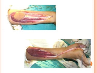 Vat gian cot sau.pptx