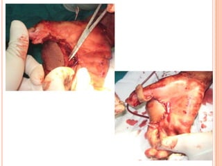 Vat gian cot sau.pptx