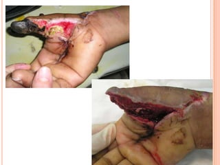 Vat gian cot sau.pptx