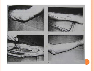 Vat gian cot sau.pptx