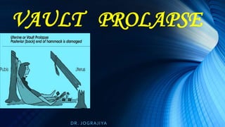 VAULT PROLAPSE
DR. JOGRAJIYA
 