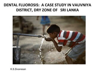 DENTAL FLUOROSIS: A CASE STUDY IN VAUVNIYA
DISTRICT, DRY ZONE OF SRI LANKA
K.S.Sivanesan
 
