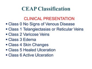 VARICOSE VEIN.pptx
