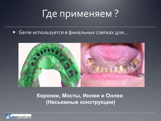 Где применяем ?
 Genie используется в финальных слепках для…
Коронки, Мосты, Инлеи и Онлеи
(Несьемные конструкции)
 