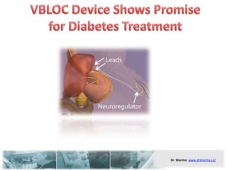 VBLOC Device Shows Promise for Diabetes Treatment 