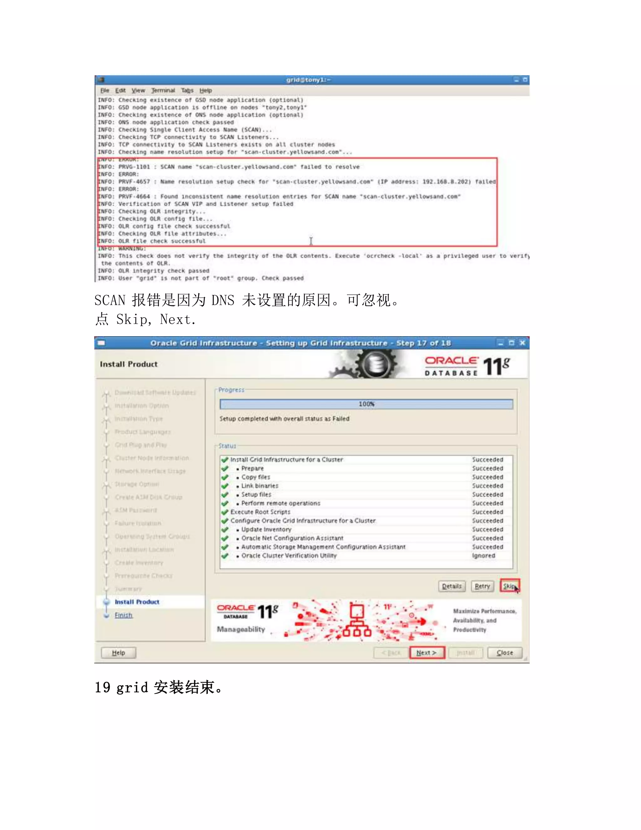 SCAN 报错是因为 DNS 未设置的原因。可忽视。
点 Skip, Next.
19 grid 安装结束。
 