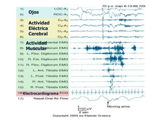 Ojos

  Actividad
  Eléctrica
  Cerebral

 Actividad
 Muscular




Electrocardiograma
 