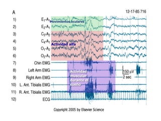 Movimientos oculares




Actividad alfa




           Actividad
           muscular
           durante el
           sueño
 