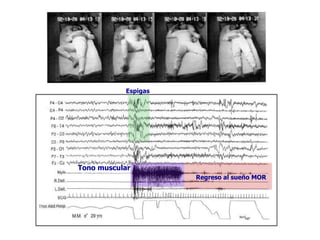 Espigas




Tono muscular
                     Regreso al sueño MOR
 