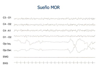 Sueño MOR




            2 Seg.
 