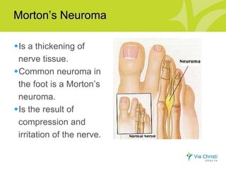 Oh, my aching feet! Presentation by Dr. Miki Matsuda | PPT